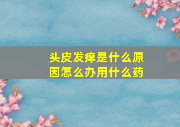 头皮发痒是什么原因怎么办用什么药