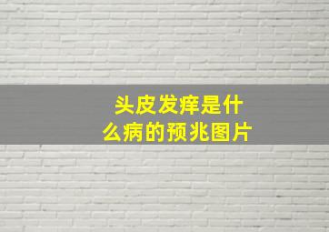 头皮发痒是什么病的预兆图片