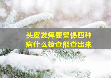 头皮发痒要警惕四种病什么检查能查出来