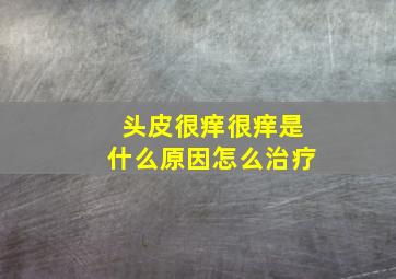 头皮很痒很痒是什么原因怎么治疗