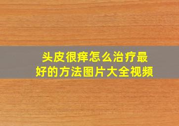 头皮很痒怎么治疗最好的方法图片大全视频