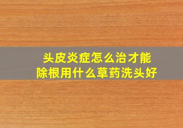 头皮炎症怎么治才能除根用什么草药洗头好