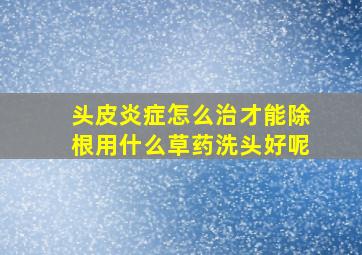 头皮炎症怎么治才能除根用什么草药洗头好呢