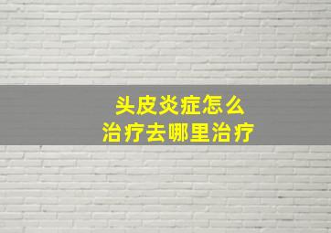 头皮炎症怎么治疗去哪里治疗