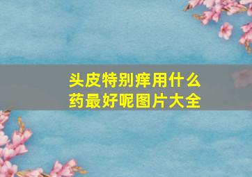 头皮特别痒用什么药最好呢图片大全