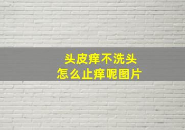 头皮痒不洗头怎么止痒呢图片