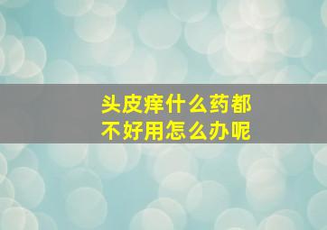 头皮痒什么药都不好用怎么办呢