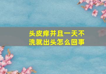 头皮痒并且一天不洗就出头怎么回事