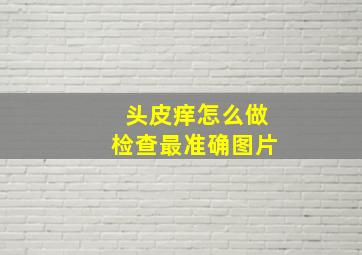 头皮痒怎么做检查最准确图片