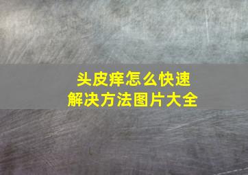 头皮痒怎么快速解决方法图片大全