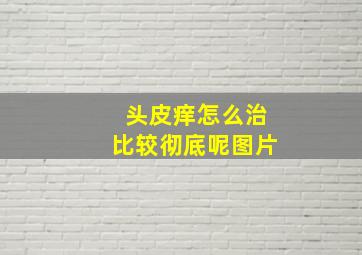 头皮痒怎么治比较彻底呢图片