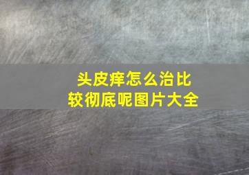 头皮痒怎么治比较彻底呢图片大全