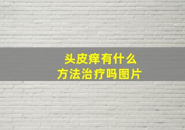 头皮痒有什么方法治疗吗图片