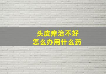 头皮痒治不好怎么办用什么药