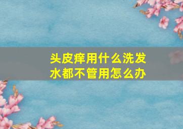 头皮痒用什么洗发水都不管用怎么办