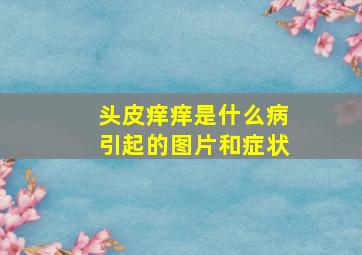 头皮痒痒是什么病引起的图片和症状