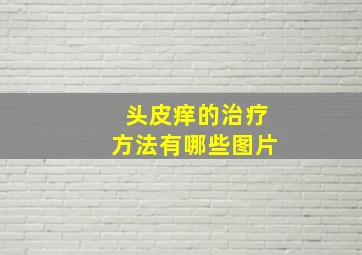 头皮痒的治疗方法有哪些图片