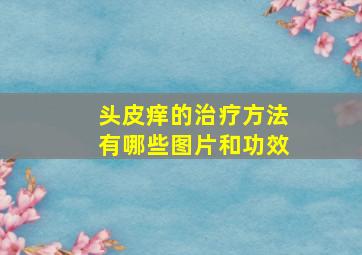 头皮痒的治疗方法有哪些图片和功效