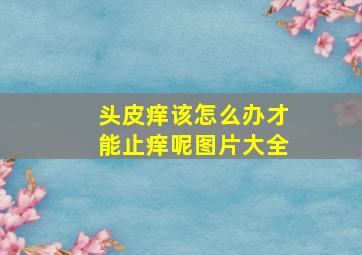 头皮痒该怎么办才能止痒呢图片大全