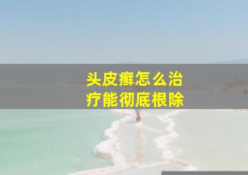 头皮癣怎么治疗能彻底根除