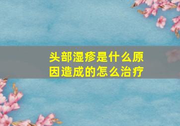 头部湿疹是什么原因造成的怎么治疗