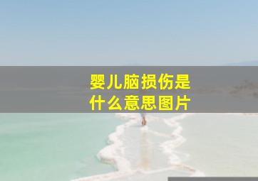 婴儿脑损伤是什么意思图片