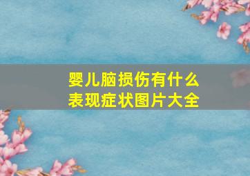 婴儿脑损伤有什么表现症状图片大全