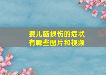 婴儿脑损伤的症状有哪些图片和视频