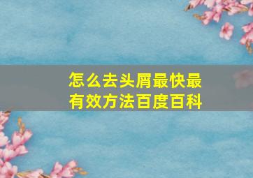 怎么去头屑最快最有效方法百度百科