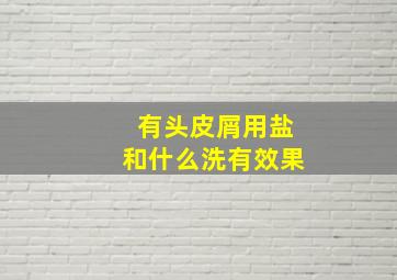 有头皮屑用盐和什么洗有效果