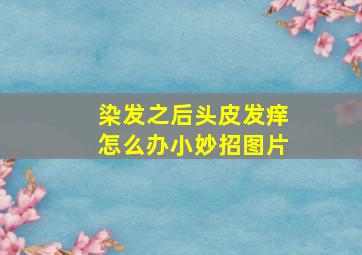 染发之后头皮发痒怎么办小妙招图片