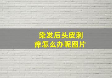 染发后头皮刺痒怎么办呢图片