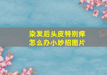 染发后头皮特别痒怎么办小妙招图片