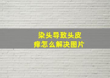 染头导致头皮痒怎么解决图片