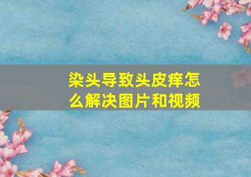 染头导致头皮痒怎么解决图片和视频