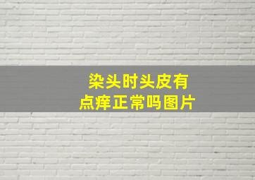 染头时头皮有点痒正常吗图片