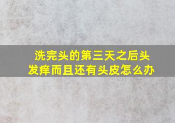 洗完头的第三天之后头发痒而且还有头皮怎么办